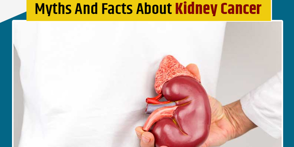 Diagnosed With Kidney Cancer? Here Are Some Myths And Facts You Should Know  - Diagnosed With Kidney Cancer? Here Are Some Myths And Facts You Should  Know