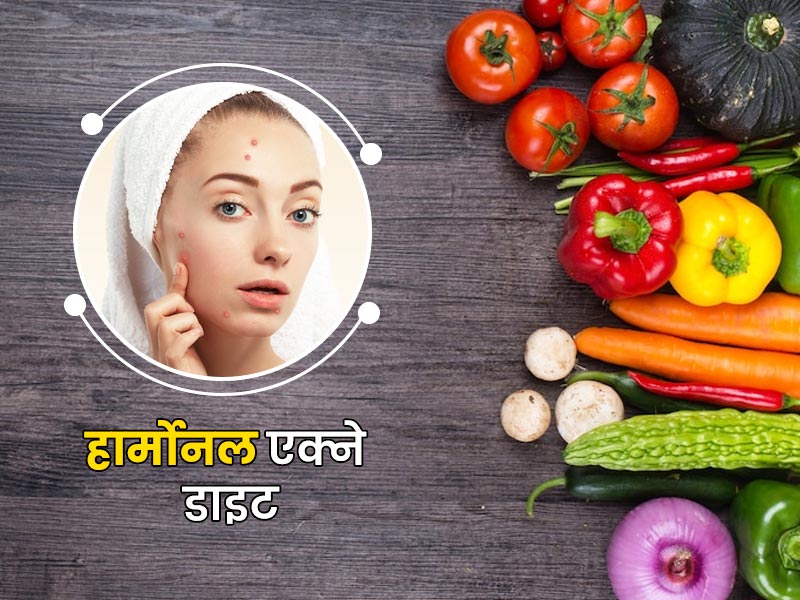 Hormonal Acne Diet: हार्मोन्स के कारण हो रहे हैं मुहांसे तो ये डाइट प्लान करें फॉलो, जल्द मिलेगा छुटकारा