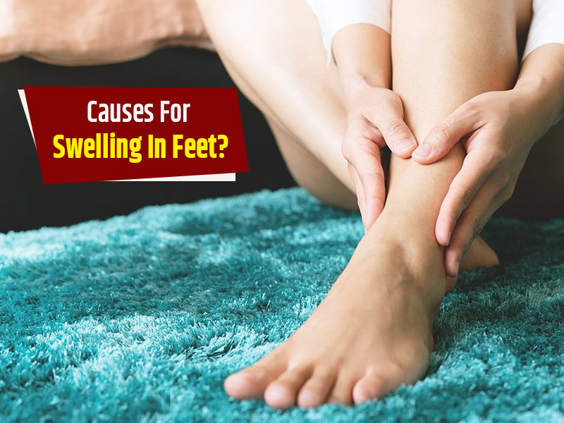 What Causes Swollen Feet? | Feet In Motion Blog