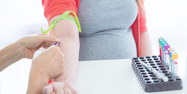 Glucose-Tolerance-Test
