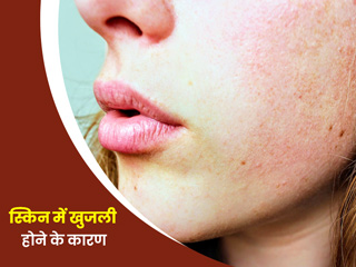 चेहरे पर खुजली और जलन के हो सकते है ये 5 कारण, जानें इससे छुटकारा पाने के उपाय