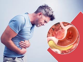पेट में ट्यूमर का इलाज क्या है? जानें डॉक्टर से