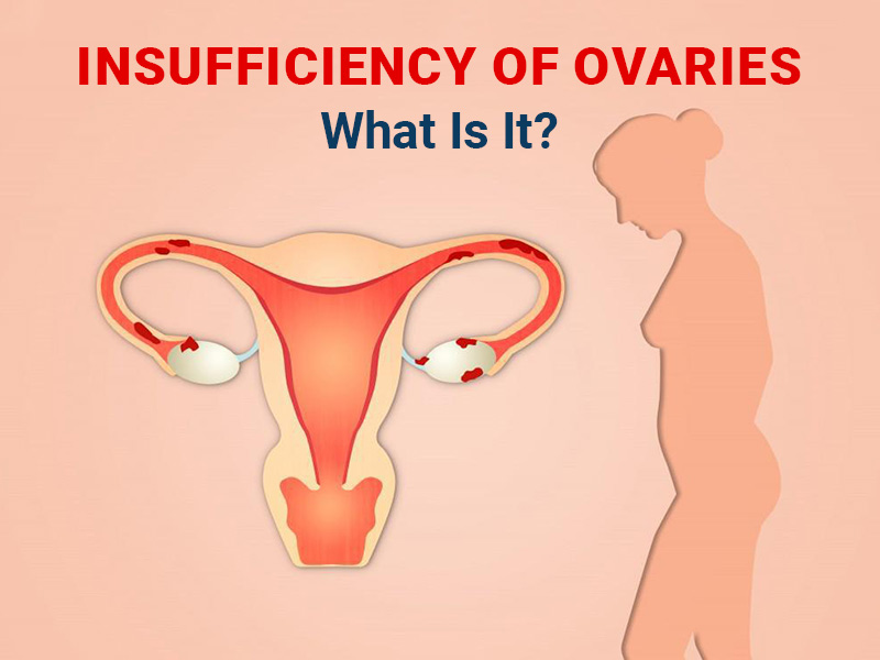 Insufficiency Of Ovaries: Symptoms And Causes