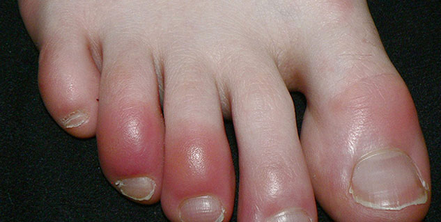 Insidechilbaineffects