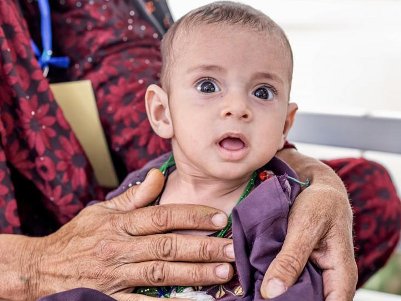 बच्चों में कुपोषण के लक्षण क्‍या हैं? जानें क्यों कुपोषित होते हैं बच्चे और क्या हैं इससे बचाव के उपाय
