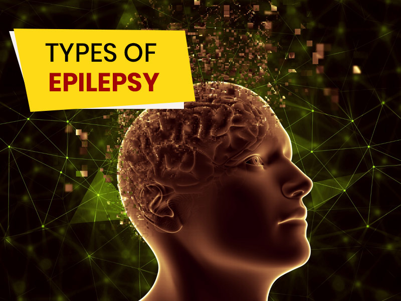 Epilepsy Has Several Types, How Are These Diagnosed? Doctor Answers