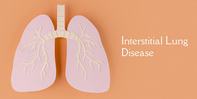 Interstitial Lung Diseases: Symptoms Causes & Risks | OnlyMyHealth