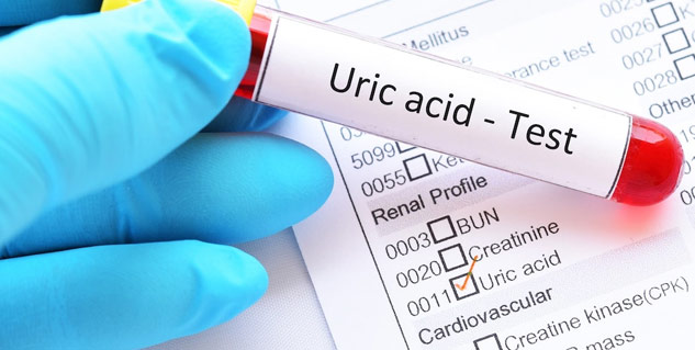 Insideuricacid