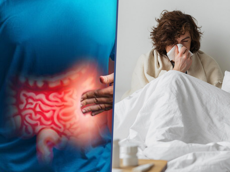 Severe COVID Detrimental To Gut Health: Study