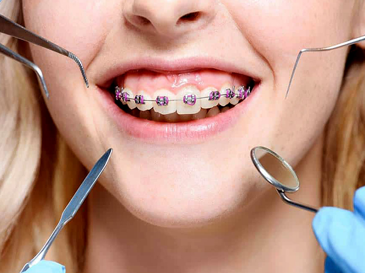 dental treatment