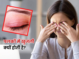 पलकों में खुजली क्यों होती है? जानें इसके लक्षण, कारण और बचाव के उपाय
