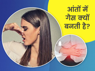 आंतों में गैस बनने के क्या कारण हैं? जानें इसके लक्षण और छुटकारा पाने के उपाय