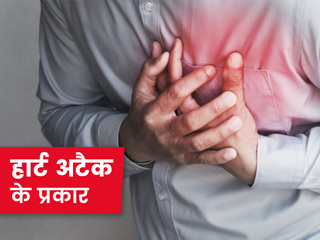 हार्ट अटैक के प्रकार: एक्सपर्ट से जानें कितने प्रकार का होता है हार्ट अटैक और इन्हें पहचानने का संकेत