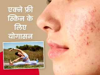 मुंहासों से छुटकारा पाने के लिए करें इन 4 योगासनों का अभ्यास, बैलेंस करते हैं शरीर में हार्मोन्स