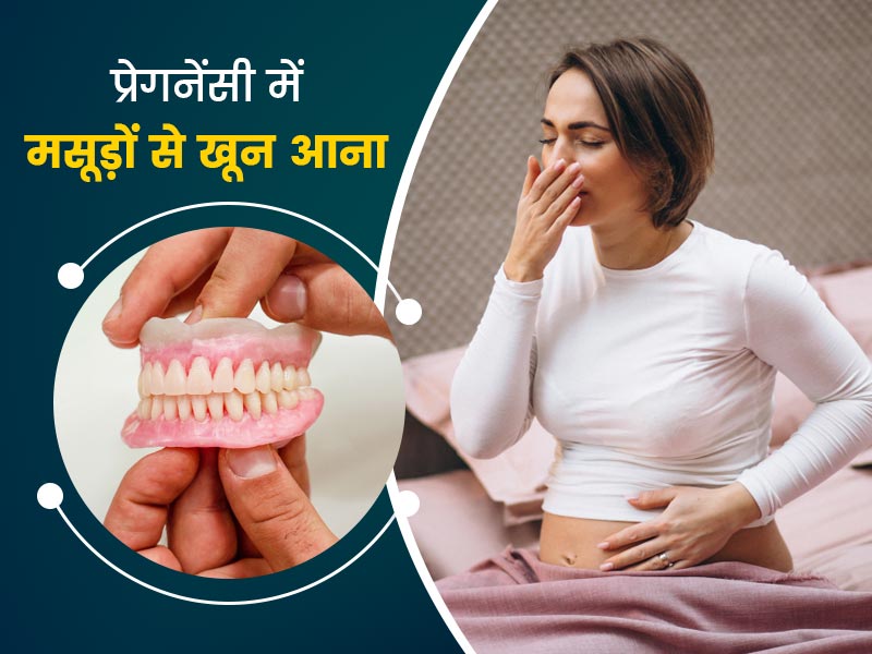 प्रेगनेंसी में मसूड़ों से खून आने के हो सकते हैं ये 5 कारण, डॉक्टर से जानें लक्षण और बचाव