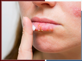 धूप के कारण होने वाले होठों के कालेपन को दूर करेंगे ये 6 उपाय, बनाएंगे होठों को सॉफ्ट और गुलाबी