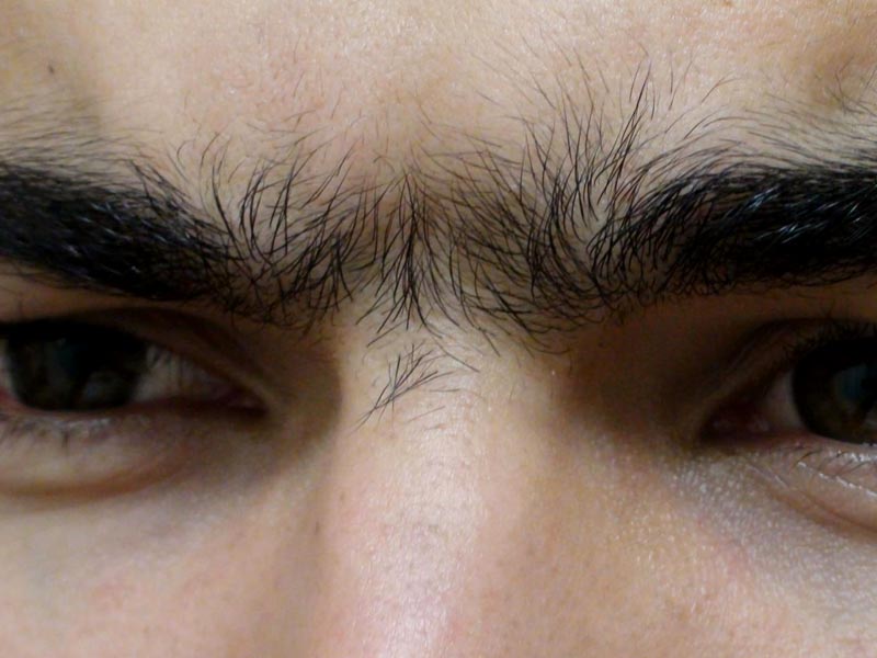 Troubled Due To Unibrow? Try These 5 Simple Ways To Get Rid Of It