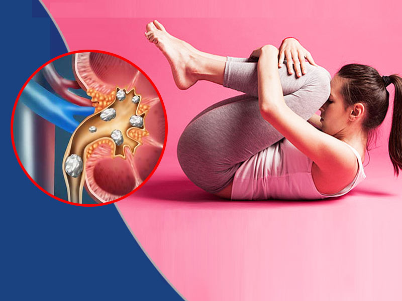 जांच में किडनी स्टोन (पथरी) का पता चलने अपनाएं ये 5 एक्सपर्ट टिप्स, जल्दी दूर होगी समस्या