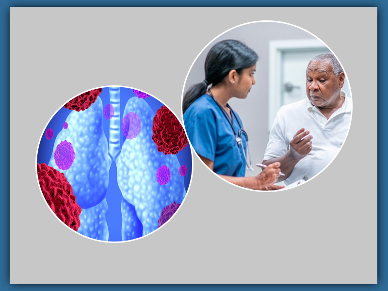 Non-Small Cell Lung Cancer: Know Stages And Treatment Process