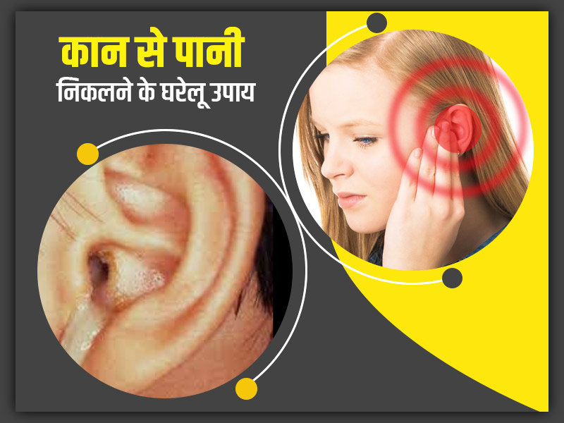 कान से पानी निकलने के होने सकते हैं ये 4 कारण, जानें समस्या से राहत पाने के घरेलू उपाय