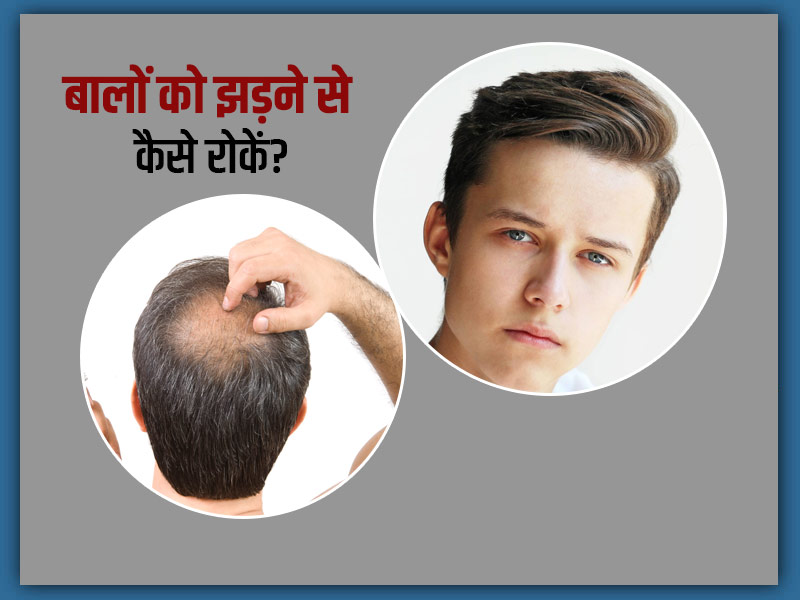 How to Prevent Hair Loss in Teenage Male in Hindi | लड़कों के बाल झड़ने के  उपाय