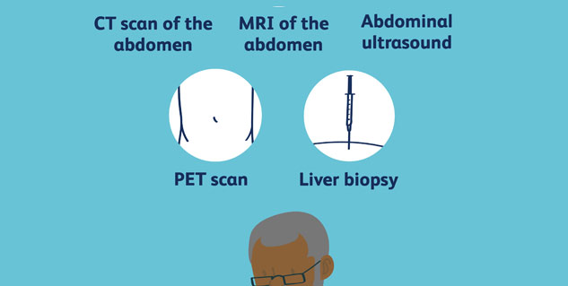 liver lump treatment