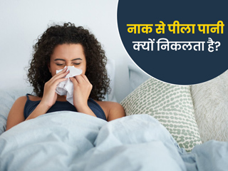 नाक से पीला पानी क्‍यों न‍िकलता है? जानें इसका कारण और इलाज