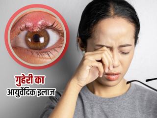 गुहेरी का आयुर्वेदिक इलाज: आंख में फुंसी (बिलनी) होने पर अपनाएं ये 9 आयुर्वेदिक उपाय, समस्या से मिलेगी राहत