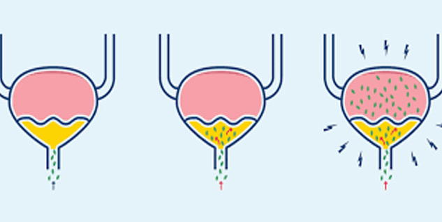 Is It Normal to Pee a Little When I Cough or Sneeze? - GoodRx