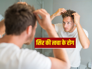 सिर की त्वचा के रोग: स्कैल्प पर अक्सर लोगों को होती हैं ये 7 समस्याएं, जानें बचाव के आसान टिप्स