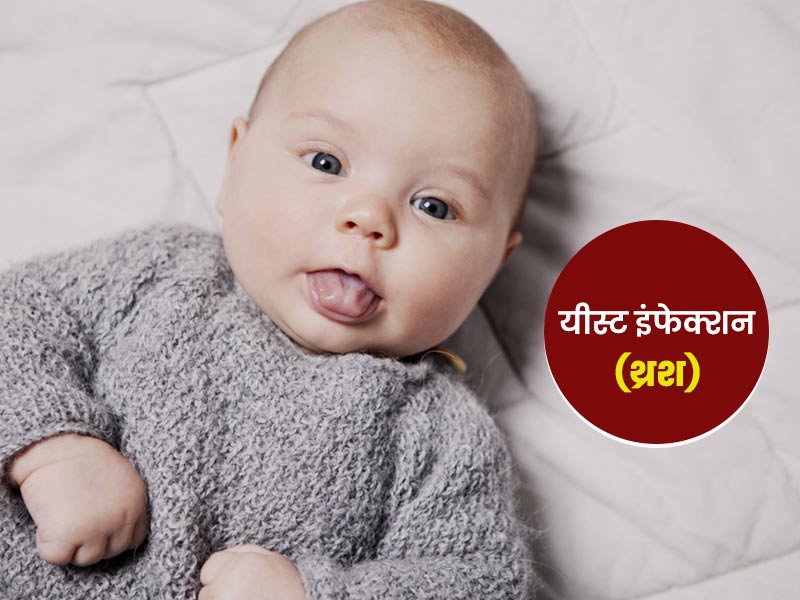 शिशु के मुंह में यीस्‍ट इंफेक्‍शन (थ्रश) की समस्‍या होने पर अपनाएं ये 5 आसान घरेलू उपाय, मिलेगा आराम