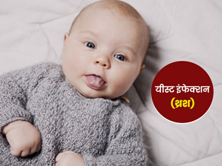 शिशु के मुंह में यीस्‍ट इंफेक्‍शन (थ्रश) की समस्‍या होने पर अपनाएं ये 5 आसान घरेलू उपाय, मिलेगा आराम