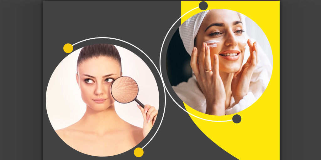 Try These 3 Homemade Winter Creams For Dry Skin Try These 3 Homemade Winter Creams For Dry Skin