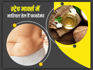 स्ट्रेच मार्क्स हटाने के लिए नारियल तेल है इन 5 तरीकों से फायदेमंद, जानें कैसे करें इस्तेमाल