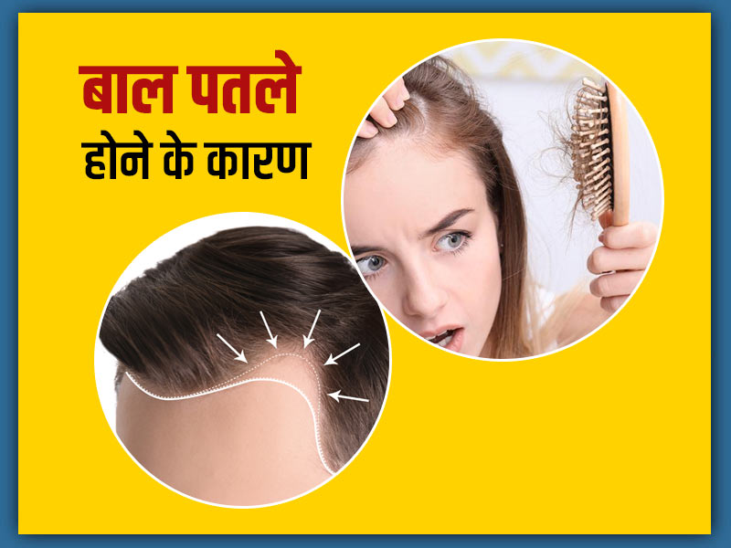 Hair thinning: बाल पतले किन कारणों से होते हैं? जानें इन्हें मजबूत और घना बनाने के आसान उपाय