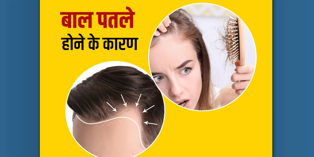 Hair Thinning Causes And Prevention Tips By Expert In Hindi | बाल पतले ...