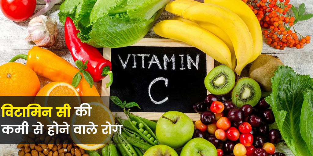 Vitamin c Deficiency Diseases and Symptoms Expert Explains in Hindi