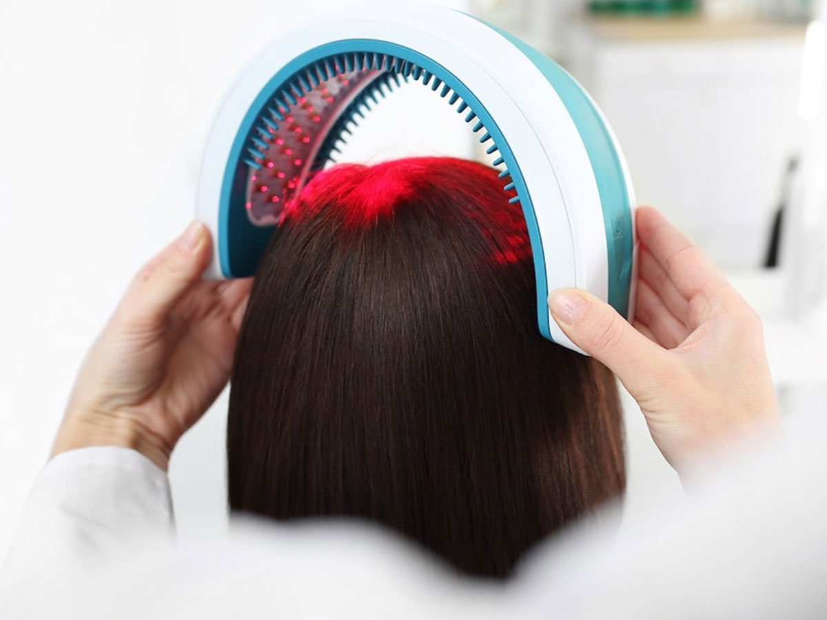 Oxygen Laser Therapy For Hair: Know How And Why Is It Beneficial In  Controlling Hair Loss | Onlymyhealth