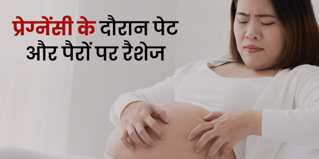 causes-for-pupp-rashes-during-pregnancy-preventions-treatment-in-hindi