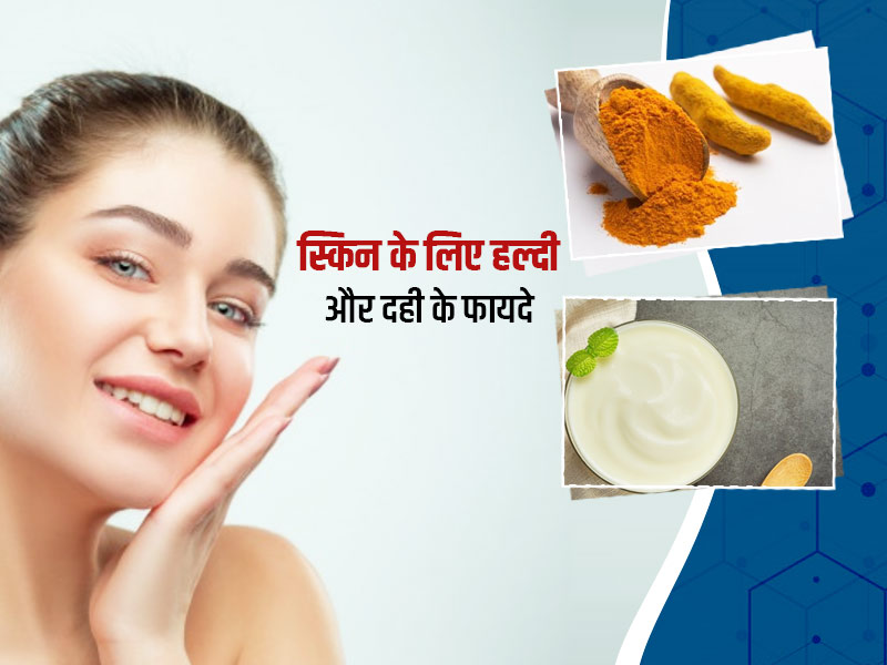 हल्दी और दही मिलाकर लगाने से स्किन को मिलते हैं ये 5 फायदे, लौट आती है त्वचा की चमक और निखार