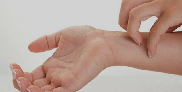 How To Get Rid Of Itchy Hands And Feet