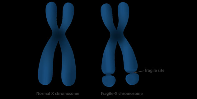 How Does Fragile X Syndrome Occur