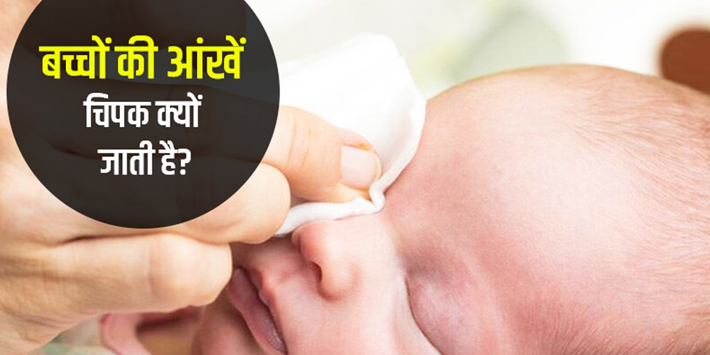 how-to-get-rid-of-sticky-eyes-in-babies-in-hindi