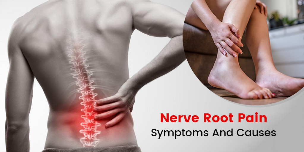 Symptoms And Causes For Nerve Root Pain, Tips To Treat Pain Onlymyhealth