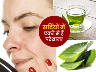 Winter Acne: सर्दियों में मुंहासों के कारण स्किन दिखने लगी बेजान? इन चीजों के इस्तेमाल कर पाएं दमकती त्वचा