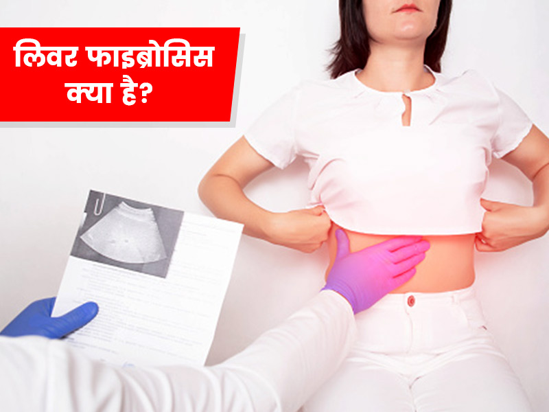 लिवर फाइब्रोसिस क्या है? जानें इस बीमारी के लक्षण, कारण और इलाज