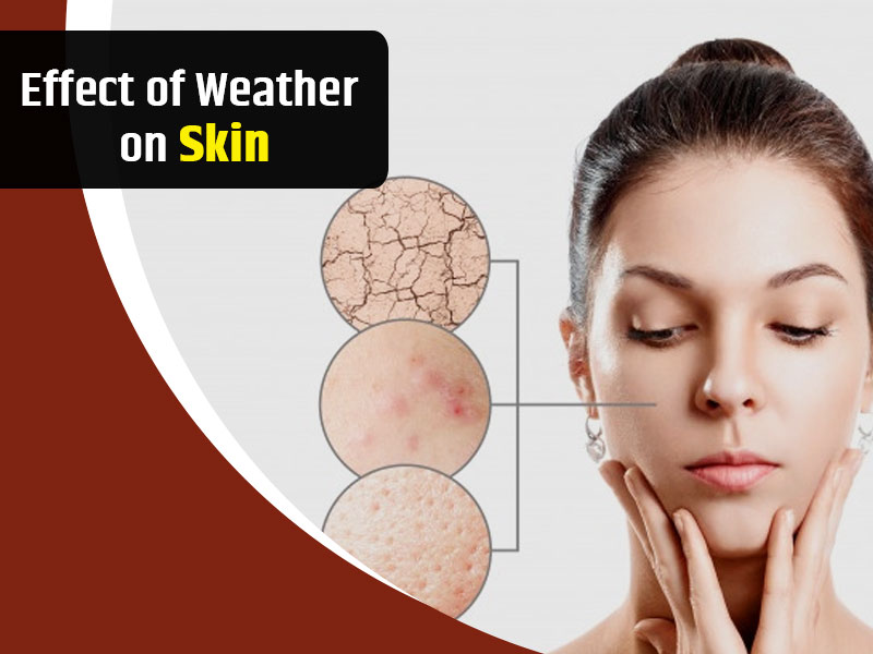 Do You Know How Weather Affects Skin? Refer To This Article