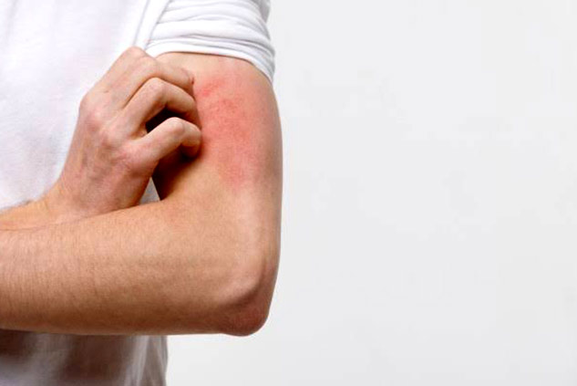 Itching In Armpits? Know These 6 Causes Of Armpit Rashes And Tips