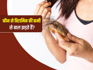 किस विटामिन की कमी से बाल झड़ते है? जानें शरीर में कैसे करें इन विटामिन्स की पूर्ति