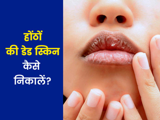 Dead Skin on Lips: होंठों के डेड स्किन को निकालने के लिए आजमाएं ये 6 आसान उपाय